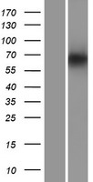 PDILT Human Over-expression Lysates NM_174924