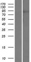 HIPK1 Human Over-expression Lysates NM_181358