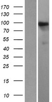 HIPK1 Human Over-expression Lysates NM_198269