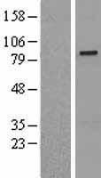 SENP5 Human Over-expression Lysates NM_152699