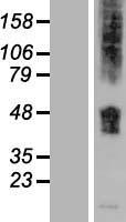 SLC36A1 Human Over-expression Lysates NM_078483