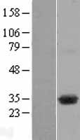 DHRSX Human Over-expression Lysates NM_145177