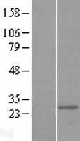 Mitocondrial Translational Initiation Factor 3 (MTIF3) Human Over-expression Lysates NM_152912