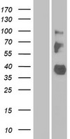 LRRC55 Human Over-expression Lysates NM_001005210