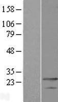 MED19 Human Over-expression Lysates NM_153450