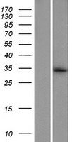 ls219557 tex47 human over expression lysates nm 152706 wb testing 1