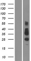 TMEM26 Human Over-expression Lysates NM_178505