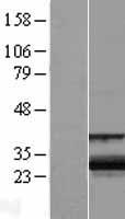 ZCCHC24 Human Over-expression Lysates NM_153367