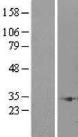 C10orf63 (ENKUR) Human Over-expression Lysates NM_145010