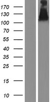 UNC5B Human Over-expression Lysates NM_170744