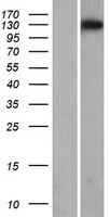 STOX1 Human Over-expression Lysates NM_152709