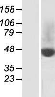 ls219855 slc37a2 human over expression lysates nm 198277 wb testing 1