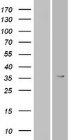 ls219874 or6t1 human over expression lysates nm 001005187 wb testing 1