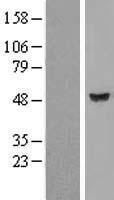 ls219899 tbcel human over expression lysates nm 001130047 wb testing 2