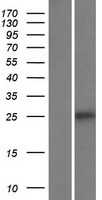 ls219902 tlcd5 human over expression lysates nm 001198670 wb testing 1