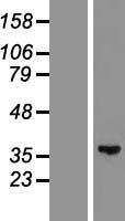 GLYATL2 Human Over-expression Lysates NM_145016