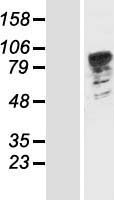 ls219988 patl1 human over expression lysates nm 152716 wb testing 1