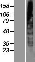 CYB561A3 Human Over-expression Lysates NM_153611