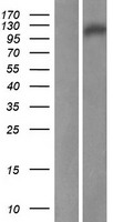 C11orf82 (DDIAS) Human Over-expression Lysates NM_145018