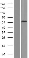 CCDC83 Human Over-expression Lysates NM_173556