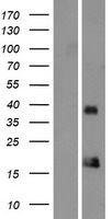 ORAV1 (ORAOV1) Human Over-expression Lysates NM_153451