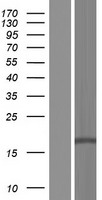 DLEU7 Human Over-expression Lysates NM_198989