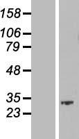 SKA1 Human Over-expression Lysates NM_001039535