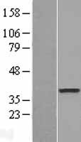 DOK6 Human Over-expression Lysates NM_152721