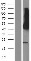 HEPACAM Human Over-expression Lysates NM_152722