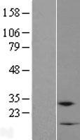 RPP38-DT Human Over-expression Lysates NM_153244