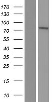 SLC39A12 Human Over-expression Lysates NM_001145195