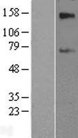 SLC39A12 Human Over-expression Lysates NM_152725