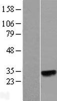 ls221143 n6amt2 eef1akmt1 human over expression lysates nm 174928 wb testing 1