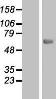 Carboxylesterase 7 (CES5A) Human Over-expression Lysates NM_145024