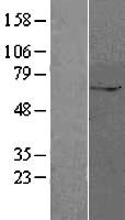 ls221302 zup1 human over expression lysates nm 145062 wb testing 1