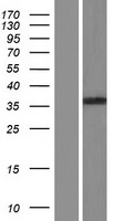 BEND6 Human Over-expression Lysates NM_152731