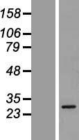 GSTA5 Human Over-expression Lysates NM_153699