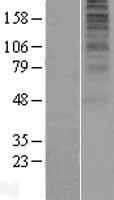 GPR136 (OPN5) Human Over-expression Lysates NM_181744