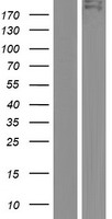 TDRD6 Human Over-expression Lysates NM_001010870