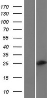 C6orf223 Human Over-expression Lysates NM_001171992
