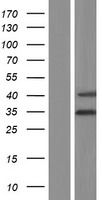 C6orf206 (RSPH9) Human Over-expression Lysates NM_001193341