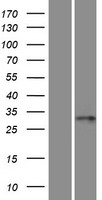 C6orf206 (RSPH9) Human Over-expression Lysates NM_152732