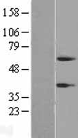 Peptidase inhibitor 16 (PI16) Human Over-expression Lysates NM_153370
