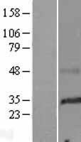 SMIM29 Human Over-expression Lysates NM_001008703
