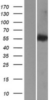 LEMD2 Human Over-expression Lysates NM_181336