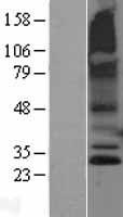 ls221687 rnf182 human over expression lysates nm 152737 wb testing 2