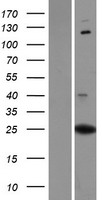 PXDC1 Human Over-expression Lysates NM_183373