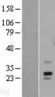 PRPS1L1 Human Over-expression Lysates NM_175886