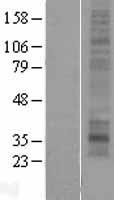 ls221938 mmd2 human over expression lysates nm 198403 wb testing 1