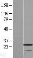 ls222008 vstm2a human over expression lysates nm 182546 wb testing 1
